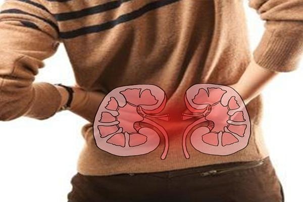 Deteksi Dini Kanker Ginjal Sebelum Terlambat